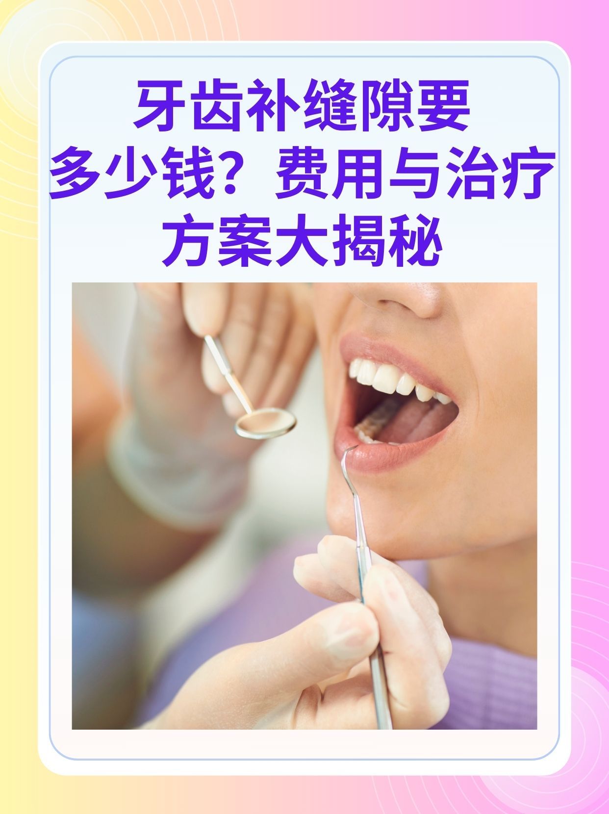 贵港补牙医保可以报销吗(补牙医保可以报销吗 哪些可以报销呢)